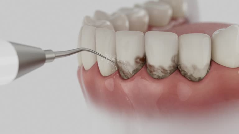 Reliable Tooth Extraction contractor in Williamsburg, VA by Smile Center Dentistry
